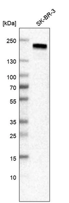 Western blot analysis in human cell line SK-BR-3.