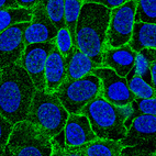 Immunofluorescent staining of human cell line MCF7 shows localization to plasma membrane.