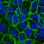 Immunofluorescent staining of human cell line MCF7 shows localization to plasma membrane.