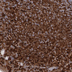 Immunohistochemical staining of human tonsil shows strong cytoplasmic positivity in germinal center cells.