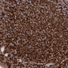 Immunohistochemical staining of human tonsil shows strong cytoplasmic positivity in germinal center cells.