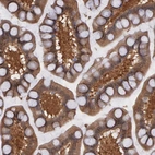 Immunohistochemical staining of human small intestine shows moderate cytoplasmic positivity in glandular cells.