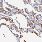 Immunohistochemical staining of human lung shows strong cytoplasmic positivity in macrophages.