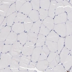Immunohistochemical staining of human skeletal muscle shows no cytoplasmic positivity in myocytes as expected.