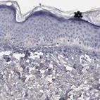 Immunohistochemical staining of human skin shows low expression as expected.