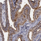 Immunohistochemical staining of human Fallopian tube shows strong membranous positivity in glandular cells.
