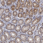 Immunohistochemical staining of human Stomach shows strong membranous positivity in glandular cells.