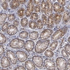 Immunohistochemical staining of human Stomach shows strong membranous positivity in glandular cells.