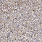Immunohistochemical staining of human Liver shows moderate membranous positivity in hepatocytes.
