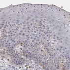 Immunohistochemical staining of human Skin shows very weak membranous positivity in squamous epithelial cells.
