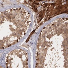 Anti-TXNRD1 Antibody