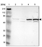 Lane 1: Marker [kDa] 219, 112, 85, 49, 32, 25, 18_br/_Lane 2: Human cell line RT-4_br/_Lane 3: Human cell line U-251MG sp_br/_Lane 4: Human cell line A-431_br/_Lane 5: Human liver tissue