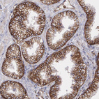 Immunohistochemical staining of human spleen shows high expression.