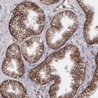 Immunohistochemical staining of human prostate shows strong membranous positivity in glandular cells.