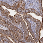 Immunohistochemical staining of human fallopian tube shows strong membranous positivity in glandular cells.