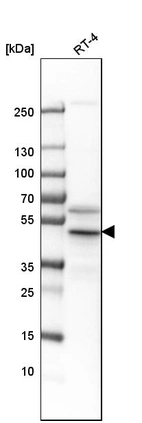 Western blot analysis in human cell line RT-4.