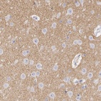 Anti-CNTN2 Antibody