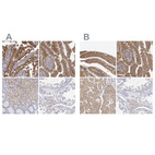 Anti-ADA Antibody