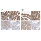 Immunohistochemical staining of human duodenum, small intestine, stomach and testis using Anti-ADA antibody HPA001399 (A) shows similar protein distribution across tissues to independent antibody HPA023884 (B).