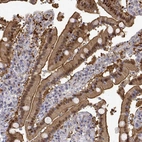 Immunohistochemical staining of human duodenum shows strong membranous and cytoplasmic positivity in glandular cells.