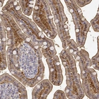 Immunohistochemical staining of human small intestine shows moderate membranous and cytoplasmic positivity in glandular cells.