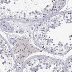 Immunohistochemical staining of human testis shows weak cytoplasmic positivity in Leydig cells as expected.