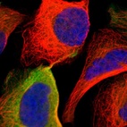 Immunofluorescent staining of human cell line U-2 OS shows localization to plasma membrane & cytosol.