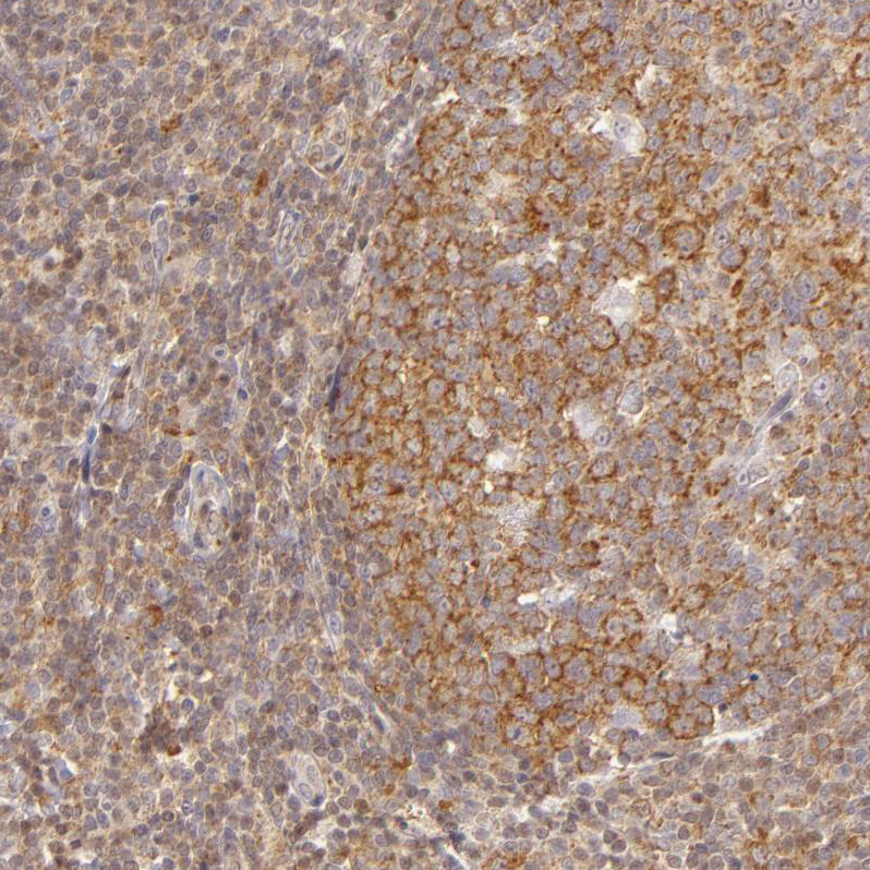 Anti-IMPDH2 Antibody