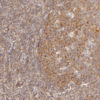 Anti-IMPDH2 Antibody