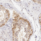 Immunohistochemical staining of human testis shows strong cytoplasmic positivity in cells in seminiferous ducts.