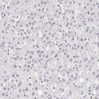 Immunohistochemical staining of human liver shows no cytoplasmic positivity in hepatocytes as expected.