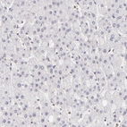 Immunohistochemical staining of human liver shows no cytoplasmic positivity in hepatocytes as expected.