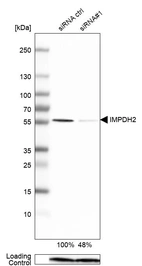 Western blot analysis in U-251MG cells transfected with control siRNA, target specific siRNA probe #1, using Anti-IMPDH2 antibody. Remaining relative intensity is presented. Loading control: Anti-PPIB.