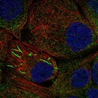 Immunofluorescent staining of human cell line A-431 shows localization to cytosol & rods & rings.