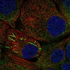 Immunofluorescent staining of human cell line A-431 shows localization to cytosol & rods & rings.