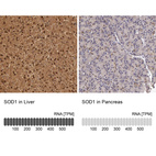 Anti-SOD1 Antibody