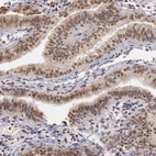 Immunohistochemical staining of human fallopian tube shows moderate nuclear positivity in glandular cells.