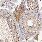 Immunohistochemical staining of human testis shows moderate nuclear and cytoplasmic positivity in cells in seminiferous ducts and Leydig cells.