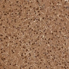 Immunohistochemical staining of human liver shows strong nuclear and cytoplasmic positivity in hepatocytes.