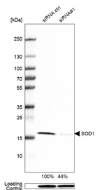 Western blot analysis in Hep-G2 cells transfected with control siRNA, target specific siRNA probe #1, using Anti-SOD1 antibody. Remaining relative intensity is presented. Loading control: Anti-GAPDH.