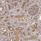 Anti-CHUK Antibody