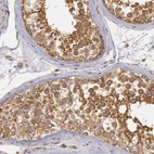 Immunohistochemical staining of human testis shows moderate cytoplasmic positivity in cells in seminiferous ducts.