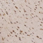 Immunohistochemical staining of human cerebral cortex shows moderate cytoplasmic positivity in neurons.