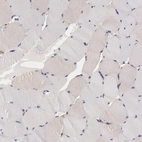 Immunohistochemical staining of human skeletal muscle shows no positivity in myocytes as expected.