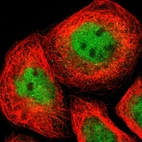 Immunofluorescent staining of human cell line A-431 shows localization to nucleoplasm & cytosol.