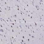 Immunohistochemical staining of human cerebral cortex shows strong nuclear positivity in neurons.