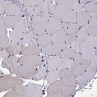 Immunohistochemical staining of human skeletal muscle shows strong nuclear positivity in myocytes.