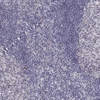 Immunohistochemical staining of human tonsil shows negative nuclear positivity in non-germinal center cells as expected.