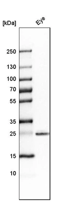 Western blot analysis in human eye tissue.
