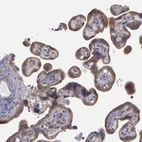 Immunohistochemical staining of human placenta shows weak to moderate cytoplasmic positivity in trophoblastic cells.